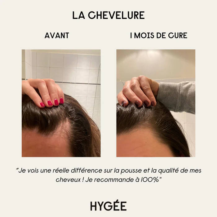 Hygée - La chevelure (cure 1 mois)