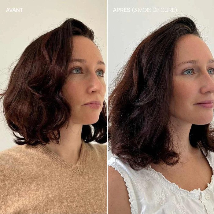 Complément alimentaire cheveux, Hair & Scalp Boost - Aime