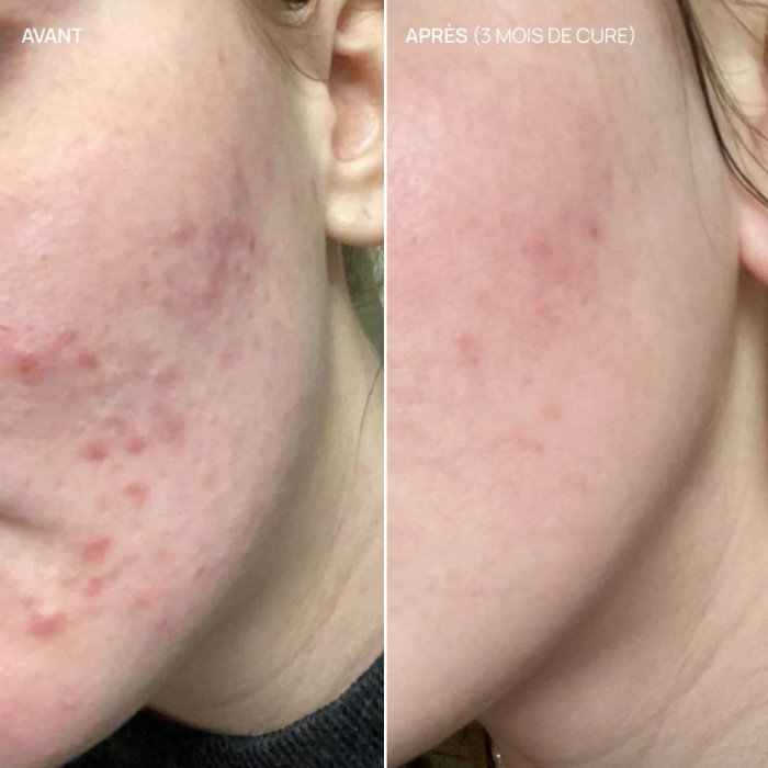 Complément alimentaire équilibre hormonal, Balance & Glow (60 gélules) - Aime
